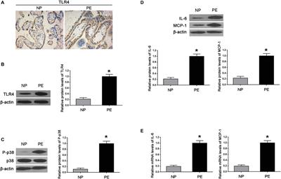 LPS Induces Preeclampsia-Like Phenotype in Rats and HTR8/SVneo Cells Dysfunction Through TLR4/p38 MAPK Pathway